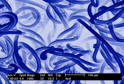 Jessica Bickel, 3rd Place - Digitally Enhanced or Colorized Images of Microstructures Jessica Bickel, 3rd Place - Digitally Enhanced or Colorized Images of Microstructures