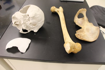 Bones
