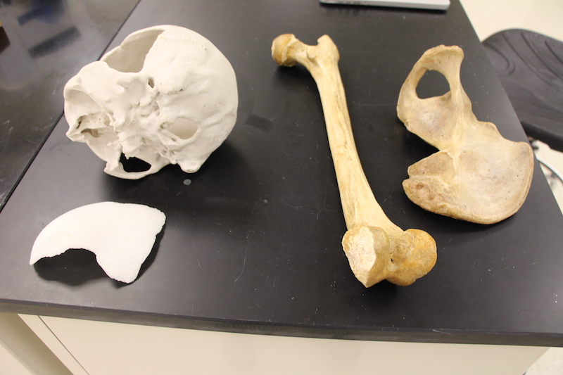 Bones
