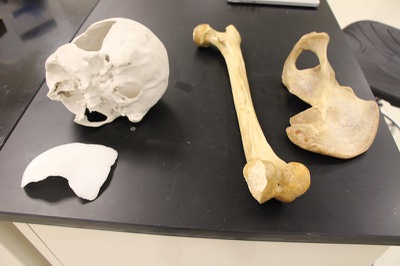 Bones