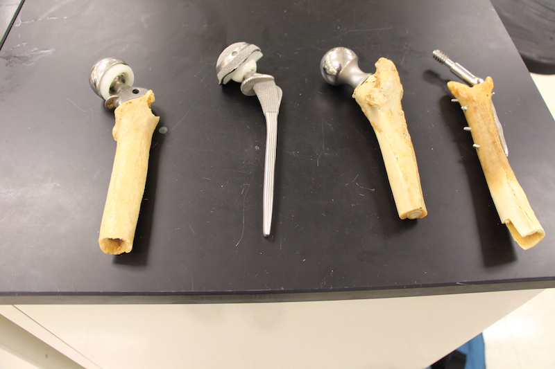 Joint Replacements